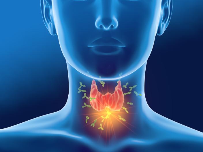 Thyroid attacked by Antibodies
